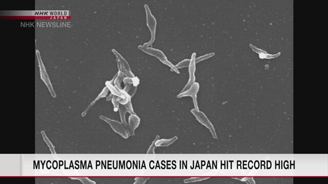 Mycoplasma pneumonia cases in Japan hit record high for third straight week